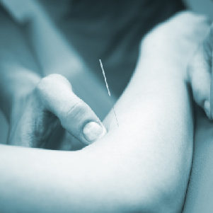 dry-needling-winterpark-co-1 dry-needling-winterpark-co-1